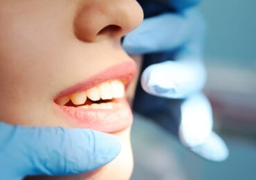 Ronco e Apneia do Sono – Implantes Dentários